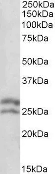 WB analysis of human lymph lysate using GTX89719 Bcl-2 antibody, N-term. Dilution : 0.1microg/ml Loading : 35microg protein in RIPA buffer WB analysis of human lymph lysate using GTX89719 Bcl-2 antibody, N-term. Dilution : 0.1microg/ml Loading : 35microg protein in RIPA buffer
