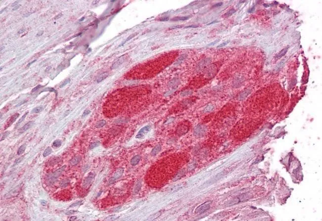 IHC-P analysis of human small intestine using GTX89724 STUB1 antibody, C-term. Antigen retrieval : citrate buffer pH 6 Dilution : 2.5microg/ml