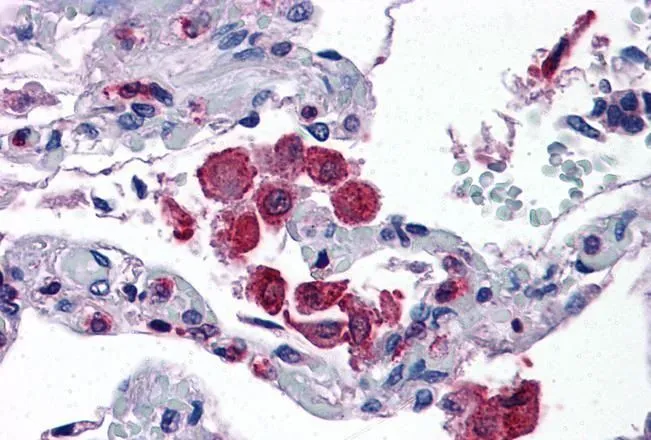 IHC-P analysis of human lung using GTX89725 FLAP antibody, C-term. Antigen retrieval : citrate buffer pH 6 Dilution : 3.75microg/ml IHC-P analysis of human lung using GTX89725 FLAP antibody, C-term. Antigen retrieval : citrate buffer pH 6 Dilution : 3.75microg/ml