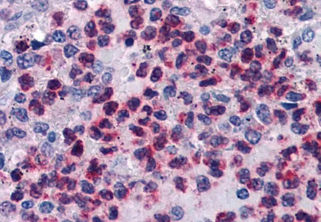 IHC-P analysis of human spleen using GTX89725 FLAP antibody, C-term. Antigen retrieval : citrate buffer pH 6 Dilution : 3.75microg/ml