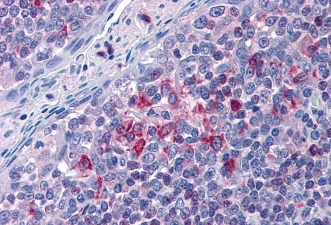 IHC-P analysis of human tonsil using GTX89725 FLAP antibody, C-term. Antigen retrieval : citrate buffer pH 6 Dilution : 3.75microg/ml