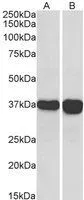 WB analysis of human liver (A) and tonsil (B) lysate using GTX89740 GAPDH antibody, C-term. Dilution : 0.1microg/ml Loading : 35microg protein in RIPA buffer WB analysis of human liver (A) and tonsil (B) lysate using GTX89740 GAPDH antibody, C-term. Dilution : 0.1microg/ml Loading : 35microg protein in RIPA buffer