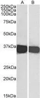 WB analysis of HEK293 (A) and HeLa (B) cell lysate using GTX89740 GAPDH antibody, C-term. Dilution : 0.1microg/ml Loading : 35microg protein in RIPA buffer