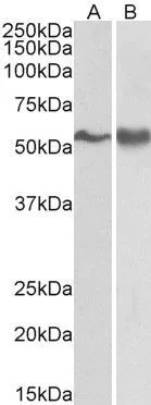 WB analysis of A431 (A) and Jurkat lysate (B) using GTX89744 FYN antibody, N-term. Dilution : 0.3microg/ml Loading : 35microg protein in RIPA buffer WB analysis of A431 (A) and Jurkat lysate (B) using GTX89744 FYN antibody, N-term. Dilution : 0.3microg/ml Loading : 35microg protein in RIPA buffer