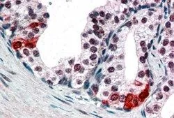 IHC-P analysis of human prostate using GTX89755 BAF57 antibody, C-term. It shows nuclear staining in secretory epithelial cells. Dilution : 3-5microg/ml IHC-P analysis of human prostate using GTX89755 BAF57 antibody, C-term. It shows nuclear staining in secretory epithelial cells. Dilution : 3-5microg/ml