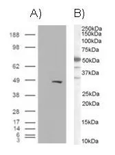 WB analysis of (A) HEK293 overexpressing BAF57 (mock transfection in first lane) (B) Jurkat lysate (35microg) using GTX89755 BAF57 antibody, C-term.