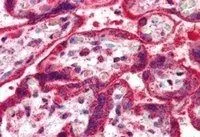 IHC-P analysis of human placenta using GTX89756 NEIL1 antibody, C-term. Antigen retrieval : citrate buffer pH 6 Dilution : 5microg/ml IHC-P analysis of human placenta using GTX89756 NEIL1 antibody, C-term. Antigen retrieval : citrate buffer pH 6 Dilution : 5microg/ml