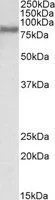 WB analysis of HepG2 lysate using GTX89766 FACL4 antibody, C-term. Dilution : 0.1microg/ml Loading : 35microg protein in RIPA buffer WB analysis of HepG2 lysate using GTX89766 FACL4 antibody, C-term. Dilution : 0.1microg/ml Loading : 35microg protein in RIPA buffer