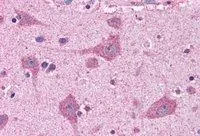 IHC-P analysis of human cortex using GTX89766 FACL4 antibody, C-term. Antigen retrieval : citrate buffer pH 6 Dilution : 3.75microg/ml