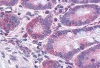 IHC-P analysis of human small intestine using GTX89766 FACL4 antibody, C-term. Antigen retrieval : citrate buffer pH 6 Dilution : 3.75microg/ml