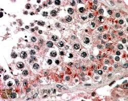 IHC-P analysis of human testis using GTX89769 ABCB9 antibody, C-term. Antigen retrieval : citrate buffer pH 6 Dilution : 3.8microg/ml IHC-P analysis of human testis using GTX89769 ABCB9 antibody, C-term. Antigen retrieval : citrate buffer pH 6 Dilution : 3.8microg/ml