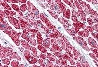 IHC-P analysis of human heart using GTX89782 VDAC2 antibody, C-term. Antigen retrieval : citrate buffer pH 6 Dilution : 5microg/ml