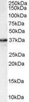 WB analysis of HEK293 lysate using GTX89783 MPG antibody, C-term. Dilution : 1microg/ml Loading : 35microg protein in RIPA buffer WB analysis of HEK293 lysate using GTX89783 MPG antibody, C-term. Dilution : 1microg/ml Loading : 35microg protein in RIPA buffer