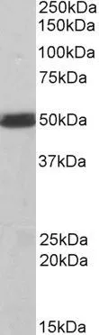 WB analysis of mouse spleen lysate using GTX89784 CSK antibody, C-term. Dilution : 1microg/ml Loading : 35microg protein in RIPA buffer WB analysis of mouse spleen lysate using GTX89784 CSK antibody, C-term. Dilution : 1microg/ml Loading : 35microg protein in RIPA buffer
