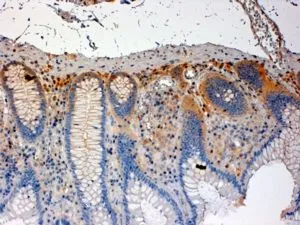 IHC-P analysis of human colon using GTX89784 CSK antibody, C-term. Antigen retrieval : citrate buffer pH 6 Dilution : 4microg/ml