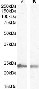 WB analysis of human skeletal muscle tissue lysate (A) and human testis tissue lysate (B) using GTX89789 Transgelin antibody, C-term. Dilution : <be>Lane A : 0.03microg/ml Lane B : 0.003microg/ml Loading : 35microg per lane