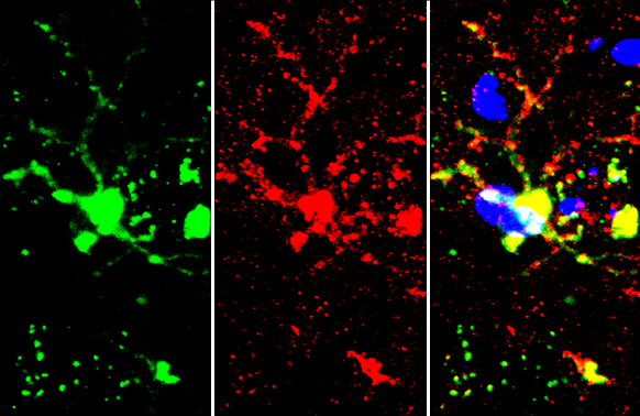 Iba1 (isoform 1 and 3) antibody, C-term detects Iba1 (isoform 1 and 3) protein by immunohistochemical analysis. Sample: Frozen-sectioned mouse brain. Green: Iba1 (isoform 1 and 3) stained by Iba1 (isoform 1 and 3) antibody, C-term (GTX89792) diluted at 1:250. Red: TMEM119, stained by TMEM119 antibody (GTX134087) diluted at 1:250. Blue: Hoechst 33342 staining.