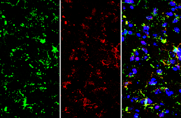 Iba1 (isoform 1 and 3) antibody, C-term detects Iba1 (isoform 1 and 3) protein by immunohistochemical analysis. Sample: Frozen-sectioned mouse brain. Green: Iba1 (isoform 1 and 3) stained by Iba1 (isoform 1 and 3) antibody, C-term (GTX89792) diluted at 1:250. Red: TMEM119, stained by TMEM119 antibody (GTX134087) diluted at 1:250. Blue: Hoechst 33342 staining.