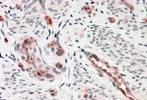 IHC-P analysis of human uterus using GTX89800 DKK3 antibody, C-term. Antigen retrieval : citrate buffer pH 6 Dilution : 3.8microg/ml IHC-P analysis of human uterus using GTX89800 DKK3 antibody, C-term. Antigen retrieval : citrate buffer pH 6 Dilution : 3.8microg/ml