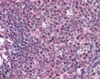 IHC-P analysis of human spleen using GTX89813 CARD11 antibody, C-term. Antigen retrieval : citrate buffer pH 6 Dilution : 2microg/ml