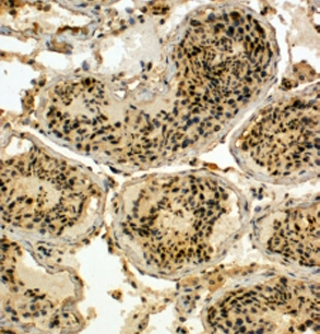 GTX89818 (4ug/ml) staining of paraffin embedded Human Testis. Steamed antigen retrieval with Tris/EDTA buffer pH 9,HRP-staining. These results could not be obtained after antigen retrieval at pH 6.