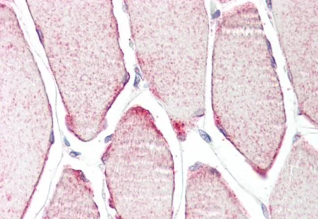 IHC-P analysis of human skeletal muscle using GTX89822 MURF3 antibody, C-term. Antigen retrieval : citrate buffer pH 6 Dilution : 3.75microg/ml