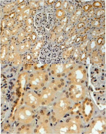 IHC-P analysis of human kidney using GTX89824 GERP antibody, C-term. Antigen retrieval : citrate buffer pH 6 Dilution : 4microg/ml IHC-P analysis of human kidney using GTX89824 GERP antibody, C-term. Antigen retrieval : citrate buffer pH 6 Dilution : 4microg/ml