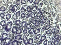 IHC-P analysis of human colon tissue without using GTX89829 Cryopyrin ( C Terminus) antibody, C-term.(Negative control)