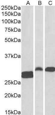 WB analysis of human tonsil (A) and rat (B) and pig (C) spleen lysate using GTX89831 ANP32B antibody, C-term. Dilution : 0.1microg/ml Loading : 35microg protein in RIPA buffer WB analysis of human tonsil (A) and rat (B) and pig (C) spleen lysate using GTX89831 ANP32B antibody, C-term. Dilution : 0.1microg/ml Loading : 35microg protein in RIPA buffer