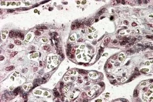 IHC-P analysis of human placenta using GTX89854 NFATC4 antibody, C-term. Antigen retrieval : citrate buffer pH 6 Dilution : 3.8microg/ml IHC-P analysis of human placenta using GTX89854 NFATC4 antibody, C-term. Antigen retrieval : citrate buffer pH 6 Dilution : 3.8microg/ml