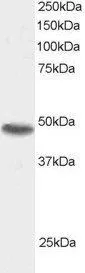 WB analysis of 293 lysate using GTX89856 SNX15 antibody, C-term. Dilution : 0.5microg/ml Loading : 30microg protein in RIPA buffer