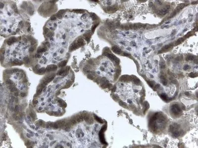 IHC-P analysis of human placenta using GTX89863 EVC2 antibody, C-term. Antigen retrieval : citrate buffer pH 6 Dilution : 2microg/ml IHC-P analysis of human placenta using GTX89863 EVC2 antibody, C-term. Antigen retrieval : citrate buffer pH 6 Dilution : 2microg/ml