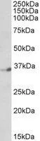 WB analysis of human brain (cerebellum) lysate using GTX89872 DPF1 antibody, C-term. Dilution : 1microg/ml Loading : 35microg protein in RIPA buffer WB analysis of human brain (cerebellum) lysate using GTX89872 DPF1 antibody, C-term. Dilution : 1microg/ml Loading : 35microg protein in RIPA buffer