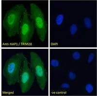 ICC/IF analysis of PFA fixed HeLa cells using GTX89879 KAP1 antibody, C-term. Green : Primary antibody Blue : DAPI Negative control : Unimmunized goat IgG Permeabilization : 0.15% Triton Dilution : 10microg/ml