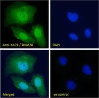 ICC/IF analysis of PFA fixed U2OS cells using GTX89879 KAP1 antibody,C-term. Green : Primary antibody Blue : DAPI Negative control : Unimmunized goat IgG Permeabilization : 0.15% Triton Dilution : 10ug/ml