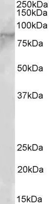 WB analysis of Molt-4 cell lysate using GTX89888 EZH1 antibody, N-term. Dilution : 2microg/ml Loading : 35microg protein in RIPA buffer WB analysis of Molt-4 cell lysate using GTX89888 EZH1 antibody, N-term. Dilution : 2microg/ml Loading : 35microg protein in RIPA buffer