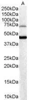 WB analysis of human brain lysate using GTX89897 FOXG1 antibody, C-term. Dilution : 0.3microg/ml Loading : 35microg protein in RIPA buffer WB analysis of human brain lysate using GTX89897 FOXG1 antibody, C-term. Dilution : 0.3microg/ml Loading : 35microg protein in RIPA buffer