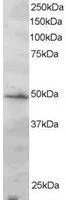 WB analysis of Jurkat lysate using GTX89898 IRF2 antibody, C-term. Dilution : 2microg/ml Loading : 30microg protein in RIPA buffer WB analysis of Jurkat lysate using GTX89898 IRF2 antibody, C-term. Dilution : 2microg/ml Loading : 30microg protein in RIPA buffer