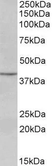 WB analysis of human lymph lysate using GTX89903 PAX5 antibody, N-term. Dilution : 0.3microg/ml Loading : 35microg protein in RIPA buffer WB analysis of human lymph lysate using GTX89903 PAX5 antibody, N-term. Dilution : 0.3microg/ml Loading : 35microg protein in RIPA buffer