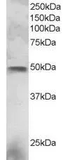 WB analysis of NCI-H460 lysate using GTX89904 ESE1 antibody, C-term. Dilution : 3microg/ml Loading : 30microg protein in RIPA buffer WB analysis of NCI-H460 lysate using GTX89904 ESE1 antibody, C-term. Dilution : 3microg/ml Loading : 30microg protein in RIPA buffer