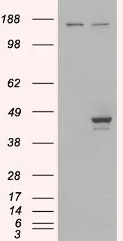 WB analysis of HEK293 overexpressing ESE1 (mock transfection in first lane) using GTX89904 ESE1 antibody, C-term.
