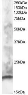 WB analysis of human brain lysate using GTX89905 CABP1 antibody, N-term. Dilution : 1microg/ml Loading : 30microg protein in RIPA buffer WB analysis of human brain lysate using GTX89905 CABP1 antibody, N-term. Dilution : 1microg/ml Loading : 30microg protein in RIPA buffer