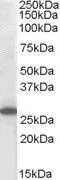 WB analysis of Molt-4 cell lysate using GTX89907 SOCS3 antibody, C-term. Dilution : 1microg/ml Loading : 35microg protein in RIPA buffer WB analysis of Molt-4 cell lysate using GTX89907 SOCS3 antibody, C-term. Dilution : 1microg/ml Loading : 35microg protein in RIPA buffer
