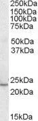 WB analysis of human heart lysate using GTX89911 KLF16 antibody, C-term. Dilution : 0.3microg/ml Loading : 35microg protein in RIPA buffer WB analysis of human heart lysate using GTX89911 KLF16 antibody, C-term. Dilution : 0.3microg/ml Loading : 35microg protein in RIPA buffer