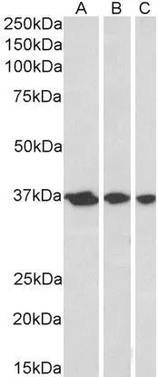 WB analysis of A431 (A), HeLa (B) and MCF7 (C) nuclear lysates using GTX89912 APE1 antibody, N-term. Dilution : 0.3microg/ml Loading : 35microg protein in RIPA buffer WB analysis of A431 (A), HeLa (B) and MCF7 (C) nuclear lysates using GTX89912 APE1 antibody, N-term. Dilution : 0.3microg/ml Loading : 35microg protein in RIPA buffer