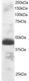 WB analysis of human testis lysate using GTX89915 TFEC antibody, N-term. Dilution : 1microg/ml Loading : 30microg protein in RIPA buffer WB analysis of human testis lysate using GTX89915 TFEC antibody, N-term. Dilution : 1microg/ml Loading : 30microg protein in RIPA buffer