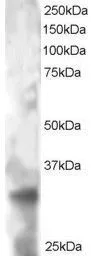 WB analysis of HeLa lysate using GTX89920 PHEMX antibody, C-term. Dilution : 2microg/ml Loading : 30microg protein in RIPA buffer WB analysis of HeLa lysate using GTX89920 PHEMX antibody, C-term. Dilution : 2microg/ml Loading : 30microg protein in RIPA buffer