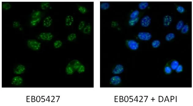 ICC/IF analysis of MCF7 cells using GTX89921 DAP3 antibody, C-term. Dilution : 5microg/ml