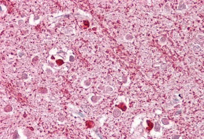 IHC-P analysis of human cortex using GTX89921 DAP3 antibody, C-term. Antigen retrieval : citrate buffer pH 6 Dilution : 2.5microg/ml