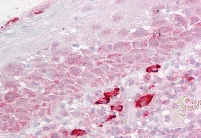 IHC-P analysis of human tonsil using GTX89921 DAP3 antibody, C-term. Antigen retrieval : citrate buffer pH 6 Dilution : 2.5microg/ml